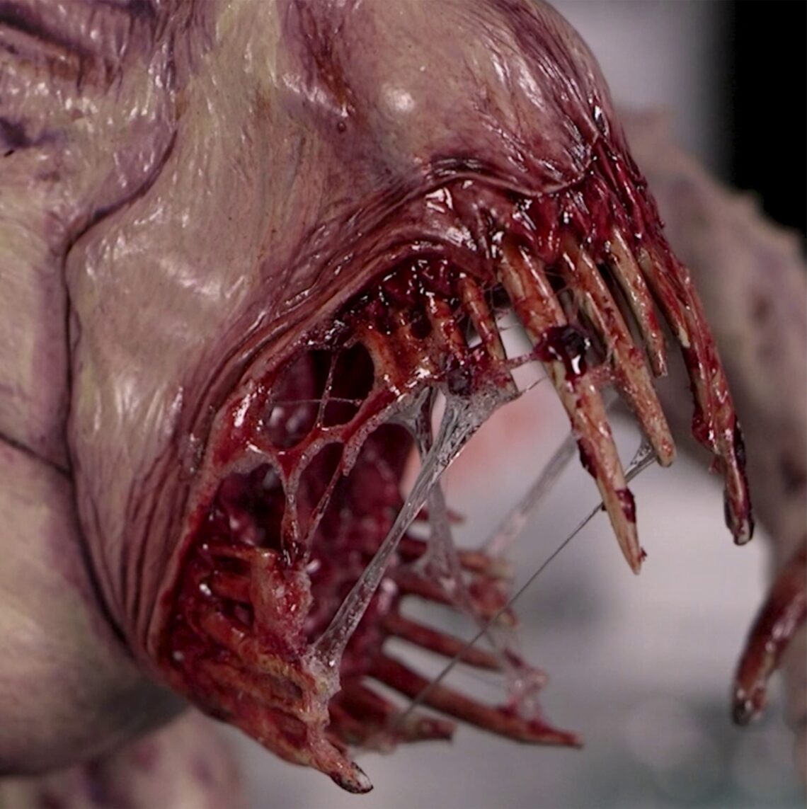 dripping teeth